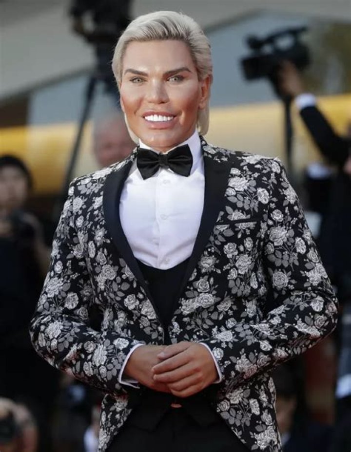 A Human Ken Doll Spent 1 MILLION Dollars on Plastic Surgeries to Look Like a Barbie