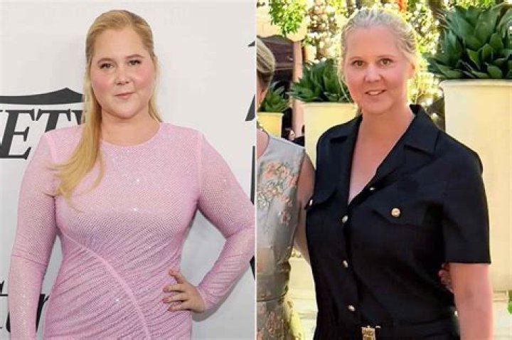 Amy Schumer's Weight And The Insights Within
