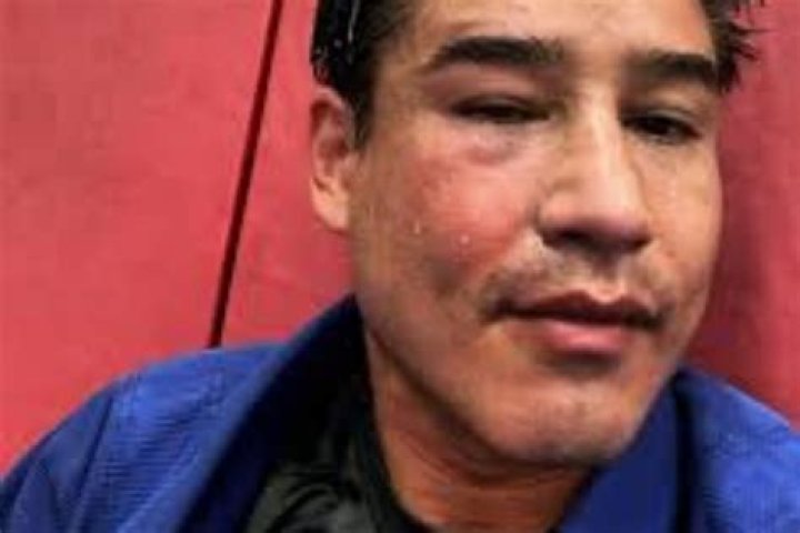 Mario Lopez Health Condition