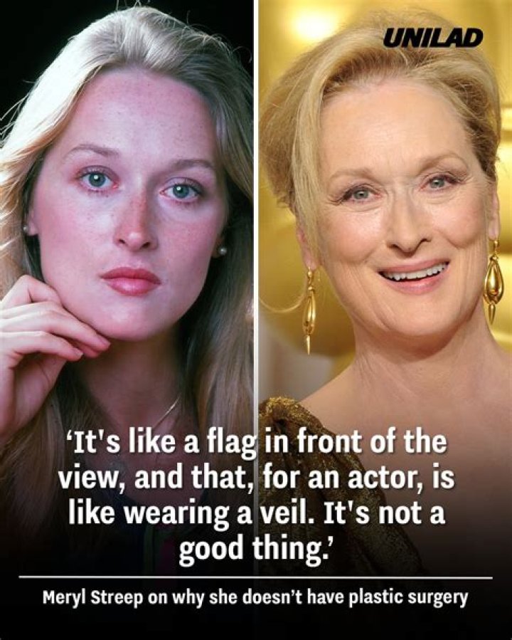 Meryl Streep's Plastic Surgery: Unveiling The Enigma