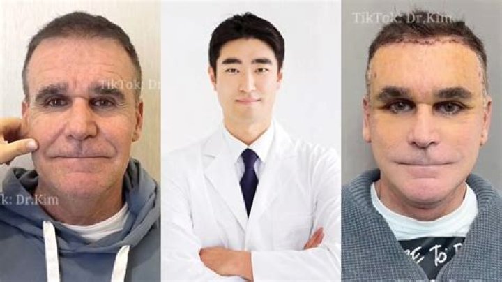 Uncovering Sb19 Pablo's Plastic Surgery Transformation